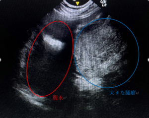 4月10日　超音波検査：腹腔内の腫瘤