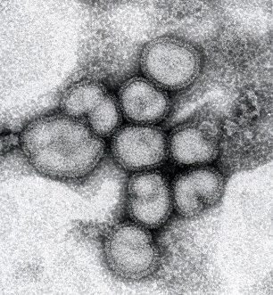 インフルエンザウイルス電子顕微鏡写真
