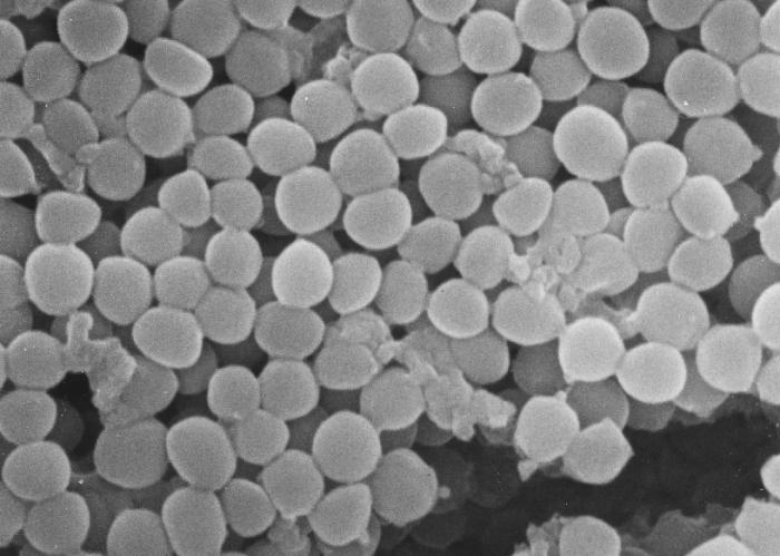 黄色ブドウ球菌(staphylococcusaureus）