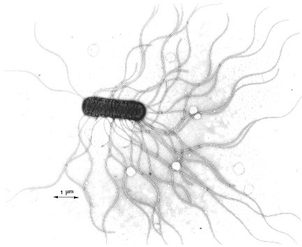 腸管出血性大腸菌O6（E.coliO6）