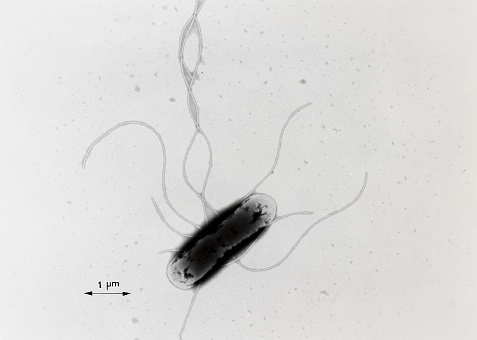 サルモネラ（salmonella）