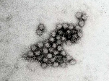 ノロウイルス（norovirus）   