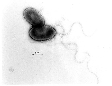 腸炎ビブリオ（vibrioparahaemolyticus）