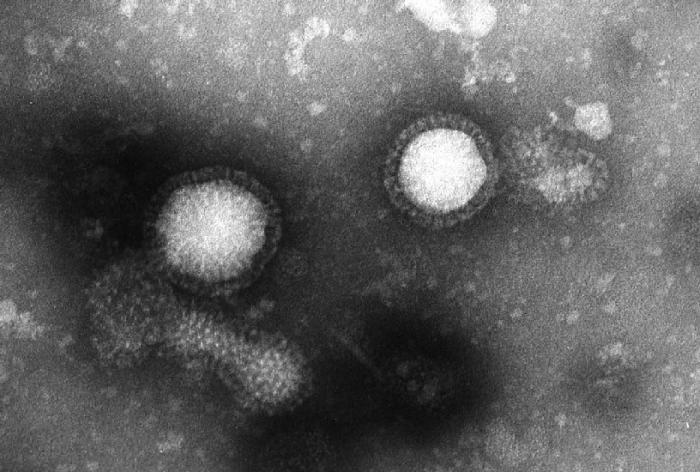 インフルエンザウイルスAH1