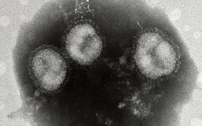 インフルエンザウイルスAH3