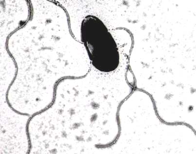 腸管出血性大腸菌O157の電子顕微鏡写真