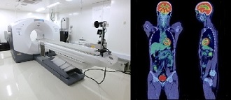 PET-CT.jpg