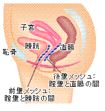 子宮脱センター図3