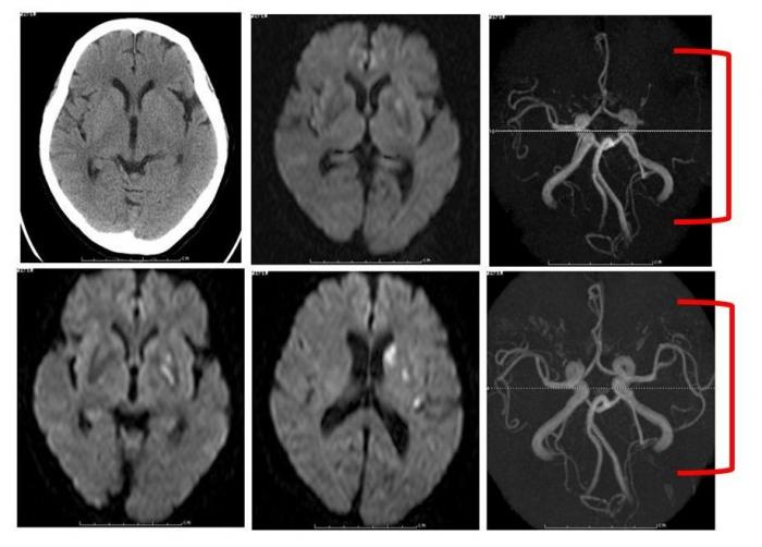 Neurology_05