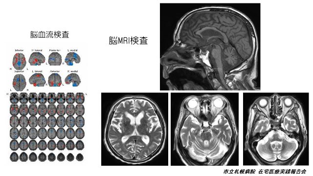 Neurology_07