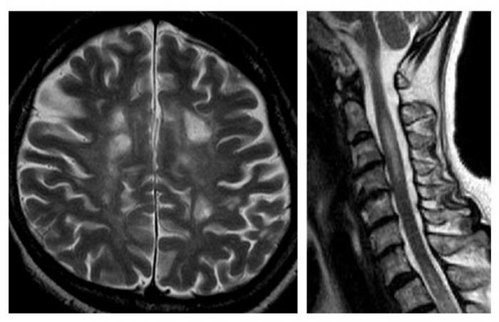 Neurology_08