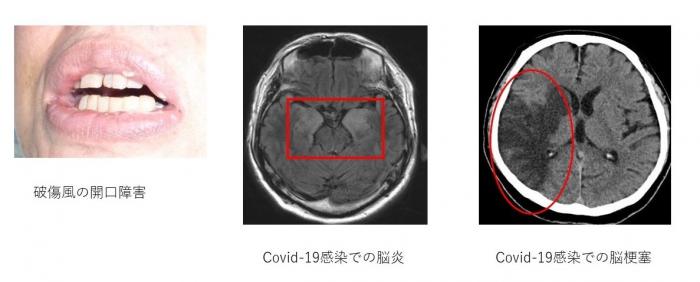 Neurology_11