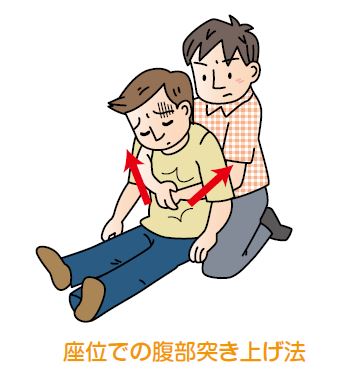座位での腹部突き上げ法の図