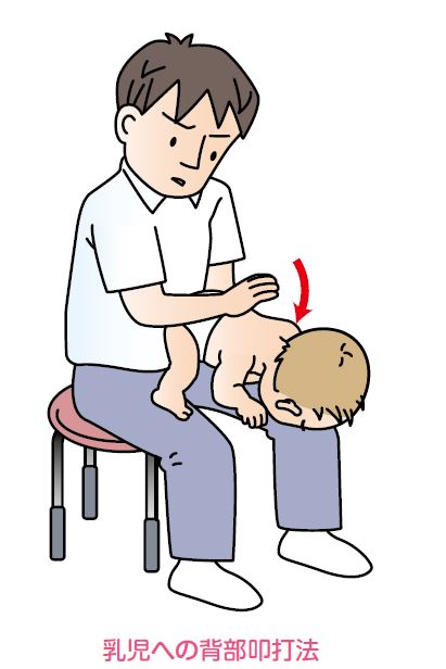 乳児への背部叩打法の図