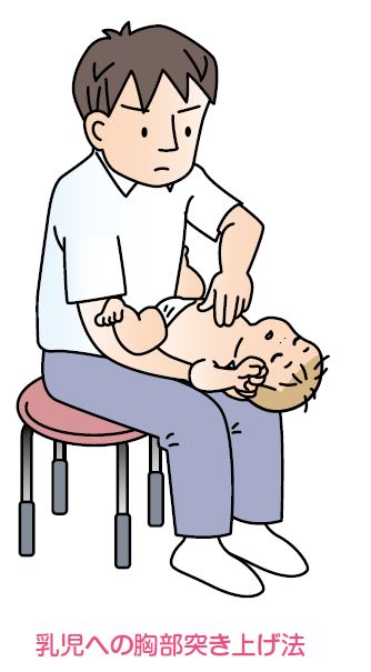 乳児への胸部突き上げ法の図
