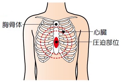 胸骨圧迫部位の図