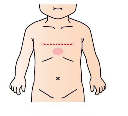 乳児の胸骨圧迫部位の図