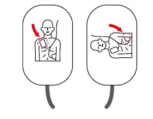 AEDの電極パッドの図