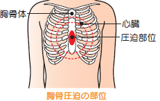 胸骨圧迫の部位イラスト