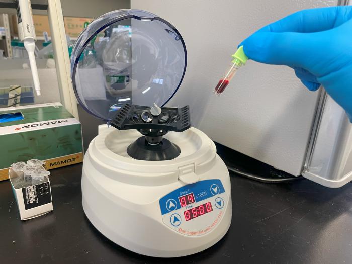 卓上遠心分離機