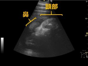超音波検査画像（頭部）